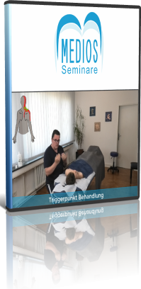 Triggerpunkt